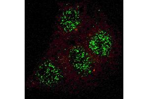 Fluorescent confocal image of HepG2 cells stained with phospho-GATA6- antibody. (GATA6 抗体  (Isoform 2, pTyr271))