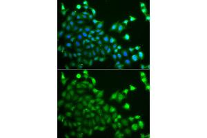 Immunofluorescence analysis of A549 cell using CBLC antibody. (CBLC 抗体)