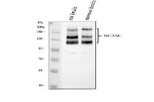 Western blot analysis of NCAM1 using anti-NCAM1 antibody (ABIN7600132).
