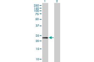 Western Blot analysis of ARL11 expression in transfected 293T cell line by ARL11 MaxPab polyclonal antibody.