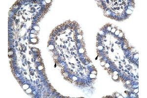 STAU1 antibody was used for immunohistochemistry at a concentration of 4-8 ug/ml to stain Epithelial cells of intestinal villus (arrows) in Human Intestine. (STAU1/Staufen 抗体)