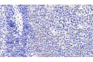 Detection of CHRM4 in Human Lymph node Tissue using Polyclonal Antibody to Cholinergic Receptor, Muscarinic 4 (CHRM4) (CHRM4 抗体)