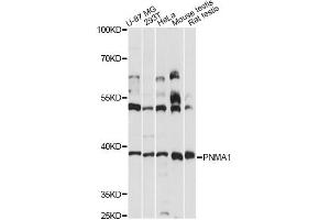 Western blot analysis of extracts of various cell lines, using PNMA1 antibody (ABIN6291181) at 1:3000 dilution. (PNMA1 抗体)