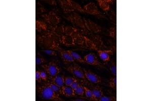 Immunofluorescence analysis of C6 cells using PI4KB antibody (ABIN7269287) at dilution of 1:100. (PI4KB 抗体  (AA 560-801))