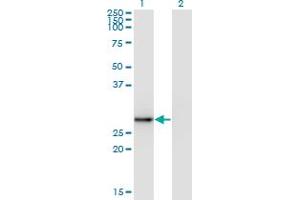 Western Blot analysis of EXOSC5 expression in transfected 293T cell line by EXOSC5 monoclonal antibody (M05), clone 1E11. (EXOSC5 抗体  (AA 1-100))