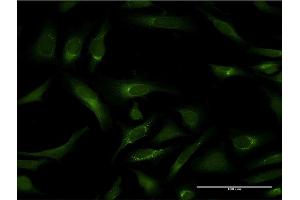 Immunofluorescence (IF) image for anti-Pipecolic Acid Oxidase (PIPOX) (AA 292-384) antibody (ABIN526592)