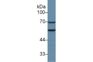 Western Blotting (WB) image for anti-CAP, Adenylate Cyclase-Associated Protein 1 (CAP1) (AA 38-149) antibody (ABIN7438262)