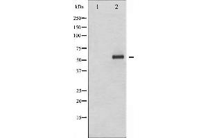 Western blot analysis of Elk1 phosphorylation expression in UV treated HeLa whole cell lysates,The lane on the left is treated with the antigen-specific peptide. (ELK1 抗体  (pSer383))