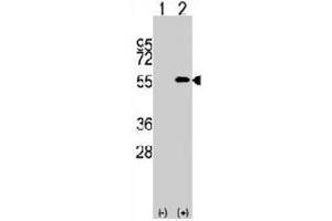 Western blot analysis of NUP50 (arrow) usingNUP50 polyclonal antibody . (NUP50 抗体  (C-Term))