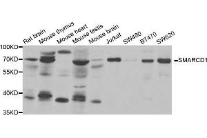 Western Blotting (WB) image for anti-SWI/SNF Related, Matrix Associated, Actin Dependent Regulator of Chromatin, Subfamily D, Member 1 (SMARCD1) antibody (ABIN1980326) (SMARCD1 抗体)