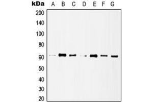 Western blot analysis of Histone Deacetylase 1 expression in MCF7 (A), HeLa (B), A431 (C), Jurkat (D), NIH3T3 (E), mouse lung (F), rat heart (G) whole cell lysates. (HDAC1 抗体  (C-Term))