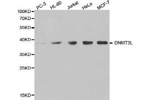 Western blot analysis of extracts of various cell lines, using DNMT3L antibody. (DNMT3L 抗体  (AA 1-386))