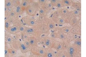IHC-P analysis of Human Liver Tissue, with DAB staining. (NOD1 抗体  (AA 612-826))