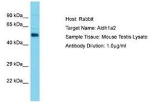 Image no. 1 for anti-Aldehyde Dehydrogenase 1 Family, Member A2 (ALDH1A2) (C-Term) antibody (ABIN6750430) (ALDH1A2 抗体  (C-Term))