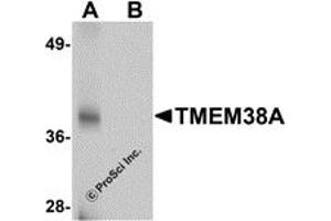 Western Blotting (WB) image for anti-Transmembrane Protein 38A (TMEM38A) (C-Term) antibody (ABIN1030754) (TMEM38A 抗体  (C-Term))
