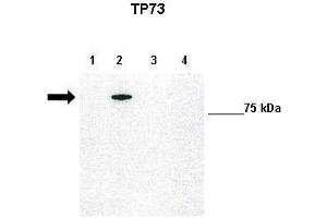 WB Suggested Anti-TP73 Antibody    Positive Control:  Lane1: 10ug untransfected H1299, Lane2: 10ug GFP-TAp73 transfected H1299, Lane3: 10ug GFP-DNp73 transfected H1299, Lane4: 10ug GFP-DBDp73 transfected H1299   Primary Antibody Dilution :   1:1000  Secondary Antibody :   Anti-rabbit-HRP   Secondry Antibody Dilution :   1:5000  Submitted by:  Francesca Grespi, VIB-Department for Molecular Biomedical Research, University of Gent (Tumor Protein p73 抗体  (N-Term))