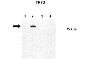 WB Suggested Anti-TP73 Antibody    Positive Control:  Lane1: 10ug untransfected H1299, Lane2: 10ug GFP-TAp73 transfected H1299, Lane3: 10ug GFP-DNp73 transfected H1299, Lane4: 10ug GFP-DBDp73 transfected H1299   Primary Antibody Dilution :   1:1000  Secondary Antibody :   Anti-rabbit-HRP   Secondry Antibody Dilution :   1:5000  Submitted by:  Francesca Grespi, VIB-Department for Molecular Biomedical Research, University of Gent