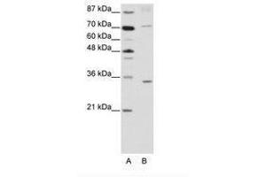 Image no. 1 for anti-Atonal Homolog 8 (ATOH8) (N-Term) antibody (ABIN202235) (ATOH8 抗体  (N-Term))