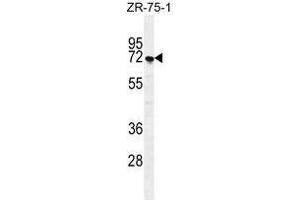 SUSD5 Antibody (C-term) western blot analysis in ZR-75-1 cell line lysates (35 µg/lane).