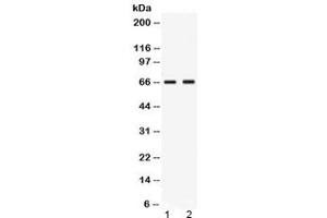 Western blot testing of human 1) MCF7 and 2) MM453 lysate with Nectin-4 antibody at 0. (PVRL4 抗体  (AA 53-94))