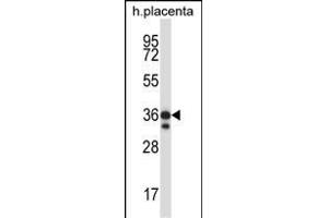 Mouse Mst4 Antibody (Center) (ABIN657993 and ABIN2846939) western blot analysis in human placenta tissue lysates (35 μg/lane). (STK26/MST4 抗体  (AA 271-299))