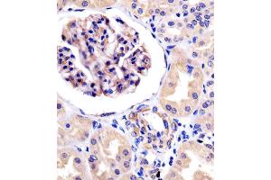 Antibody staining ROR1 in human kidney tissue sections by Immunohistochemistry (IHC-P - paraformaldehyde-fixed, paraffin-embedded sections). (ROR1 抗体)