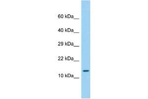 Host: Rabbit Target Name: LEPROTL1 Sample Type: Fetal Liver lysates Antibody Dilution: 1. (LEPROTL1 抗体  (N-Term))