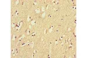 Immunohistochemistry of paraffin-embedded human brain tissue using ABIN7164461 at dilution of 1:100 (GPR156 抗体  (AA 614-814))