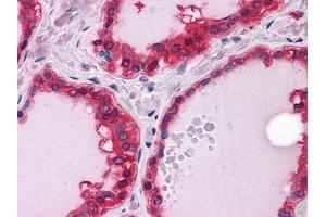 Immunohistochemical analysis of paraffin-embedded human Thyroid tissues using ST13 mouse mAb (HSC70 Interacting Protein HIP 抗体)