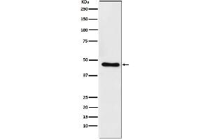 Western blot analysis of CtBP1 expression in Raji cell lysate.