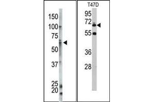 Image no. 1 for anti-Ubiquilin 1 (UBQLN1) (N-Term) antibody (ABIN357617) (Ubiquilin 1 抗体  (N-Term))