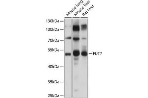 Western blot analysis of extracts of various cell lines, using FUT7 Antibody (ABIN6133982, ABIN6140825, ABIN6140826 and ABIN6224983) at 1:1000 dilution. (FUT7 抗体  (AA 100-200))