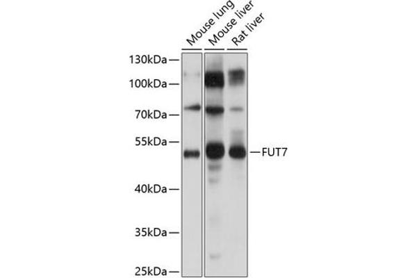 FUT7 anticorps  (AA 100-200)