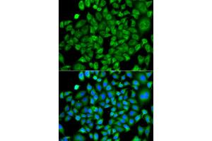 Immunofluorescence analysis of A549 cells using NAA50 antibody. (NAA50 抗体)