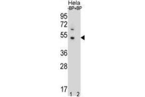 Western Blotting (WB) image for anti-DnaJ (Hsp40) Homolog, Subfamily B, Member 6 (DNAJB6) (AA 217-247), (Middle Region) antibody (ABIN951944)