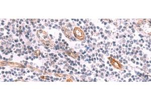 Immunohistochemistry of paraffin-embedded Human tonsil tissue using KCNK15 Polyclonal Antibody at dilution of 1:45(x200) (KCNK15 抗体)