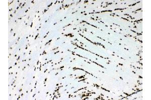 Immunohistochemistry (IHC) image for anti-Musashi Homolog 1 (Drosophila) (MSI1) (AA 21-54), (N-Term) antibody (ABIN5518855)