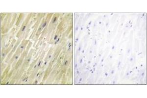 Immunohistochemistry analysis of paraffin-embedded human heart tissue, using M-CK Antibody. (CKM 抗体  (AA 10-59))