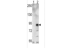 Western blot analysis of EphA5 (arrow) using rabbit polyclonal EphA5 Antibody (ABIN391894 and ABIN2841713). (EPH Receptor A5 抗体)
