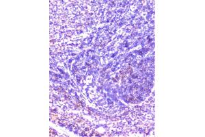 IHC analysis of cortactin using anti-cortactin antibody (ABIN6719306). (Cortactin 抗体  (AA 1-105))