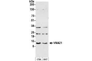 anti-Vacuolar H+-ATPase Homolog (VMA21) (AA 51-101) antibody