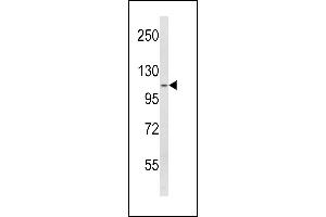 Western Blotting (WB) image for anti-serine Peptidase Inhibitor, Kazal Type 5 (SPINK5) (AA 188-217), (N-Term) antibody (ABIN390855)