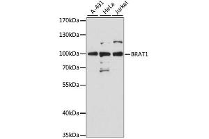 Western blot analysis of extracts of various cell lines, using Brat1 antibody (ABIN6290105) at 1:3000 dilution. (BAAT1 抗体)