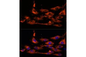 Immunofluorescence analysis of C6 cells using  antibody (ABIN7265422) at dilution of 1:100. (ACOX3 抗体  (AA 10-100))