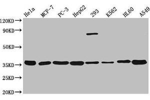 Western Blot Positive WB detected in: Hela whole cell lysate, MCF-7 whole cell lysate, PC-3 whole cell lysate, HepG2 whole cell lysate, 293 whole cell lysate, K562 whole cell lysate, HL60 whole cell lysate, A549 whole cell lysate All lanes: ANXA5 antibody at 1:3000 Secondary Goat polyclonal to rabbit IgG at 1/50000 dilution Predicted band size: 36 kDa Observed band size: 36 kDa (Annexin V 抗体  (AA 2-320))
