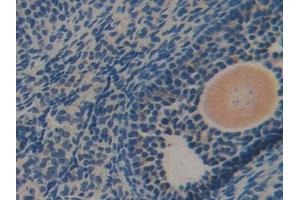 Detection of DLD in Mouse Ovary Tissue using Polyclonal Antibody to Dihydrolipoyl Dehydrogenase (DLD)