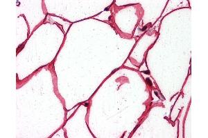 Anti-SHC1 antibody IHC of human adipocytes. (SHC1 抗体  (AA 171-280))