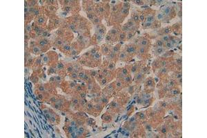 Used in DAB staining on fromalin fixed paraffin- embedded liver tissue (TOLLIP 抗体  (AA 28-261))
