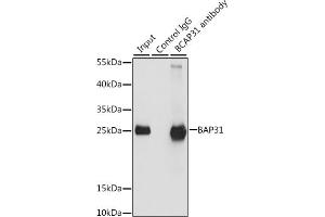 Immunoprecipitation analysis of 200 μg extracts of HeLa cells, using 3 μg B antibody (ABIN6129973, ABIN6137477, ABIN6137478 and ABIN6222845). (BCAP31 抗体  (AA 127-246))