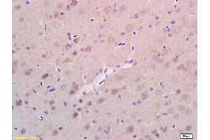 Formalin-fixed and paraffin embedded rat brain labeled with Anti-RHEB Polyclonal Antibody, Unconjugated (ABIN704771) at 1:200 followed by conjugation to the secondary antibody and DAB staining. (RHEB 抗体  (AA 101-184))